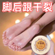 基肤源基肤源干裂膏秋冬必备防干防裂滋润嫩滑护脚护手保湿