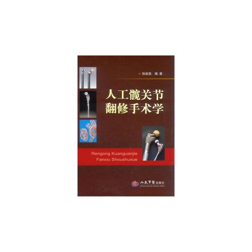 【正版书籍】人工髋关节翻修手术学孙俊英著人民军医出版社