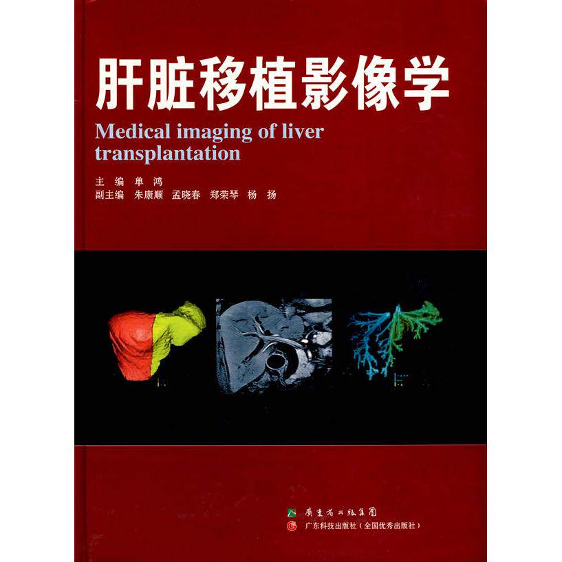 【正版书籍】肝脏移植影像学单鸿广东科技出版社9787535945549