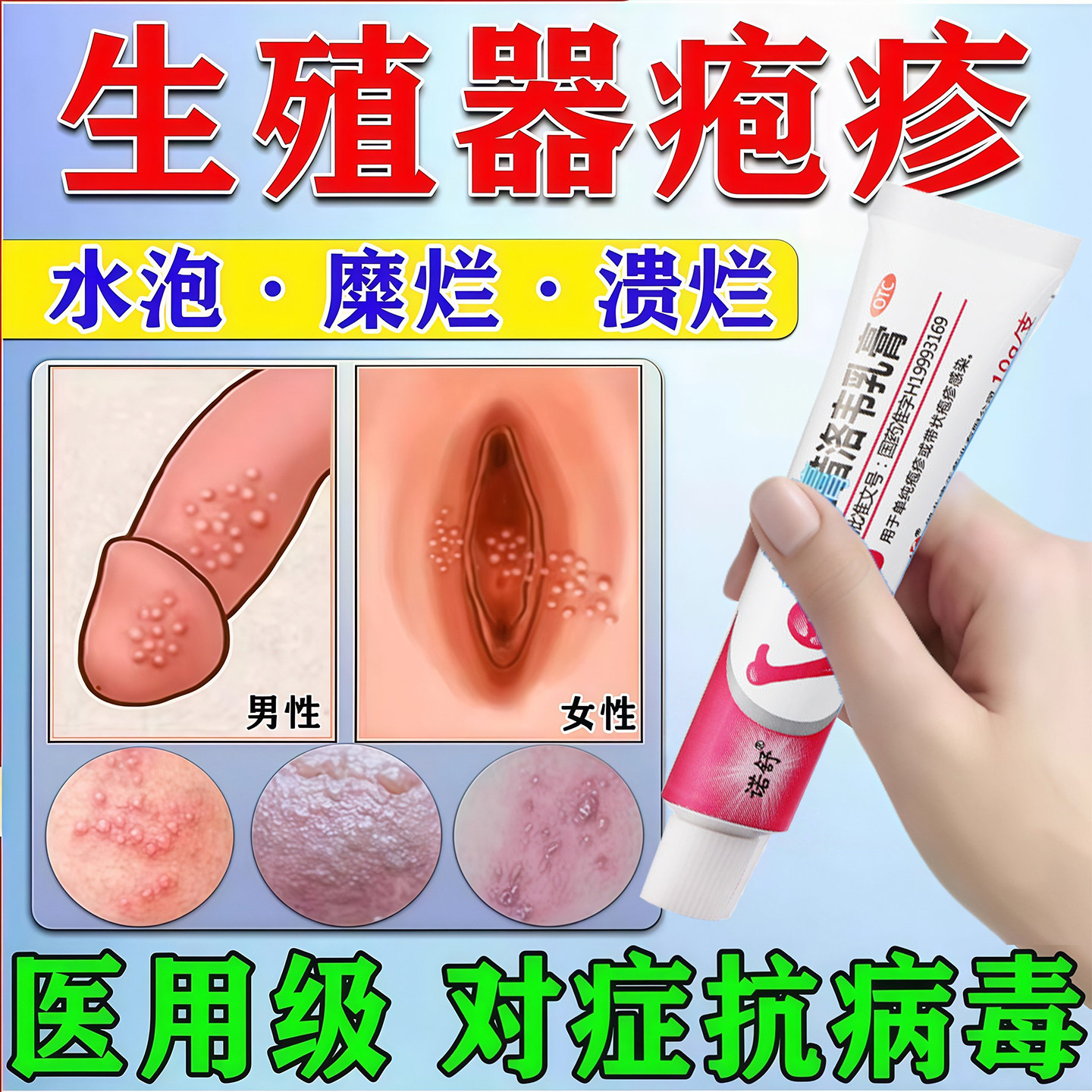 正品阿昔洛韦乳膏软膏抗病毒生殖器私处带状疱疹真菌感染瘙痒cx