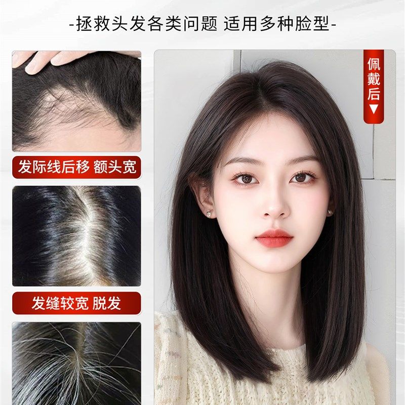 递针假发女片头顶真发全真人发遮白发增发量蓬松自然无痕刘海补发