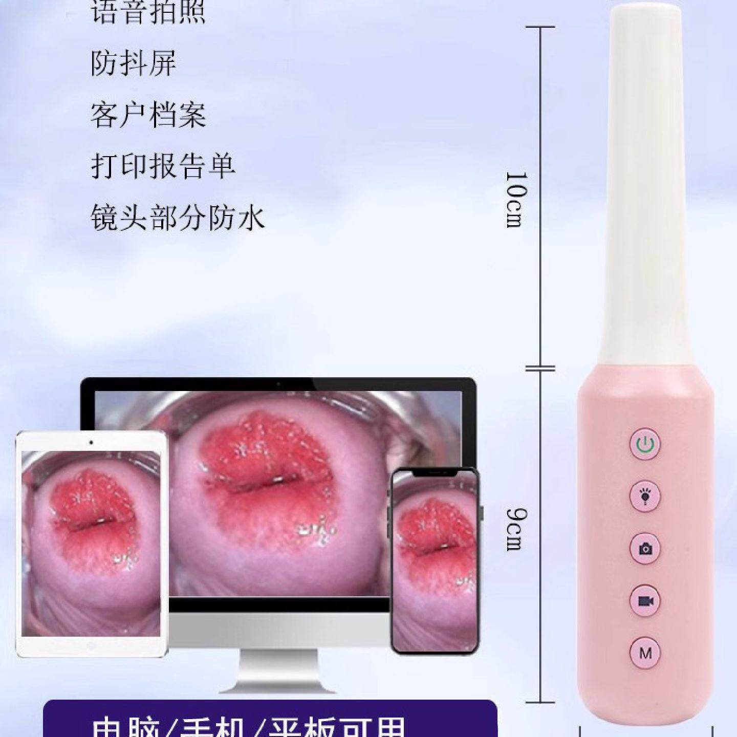 阴道镜阴道内窥镜检测仪妇科宫颈私密检查仪器可视高清无线摄像头
