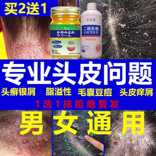 治头皮癣银屑脂溢性皮炎毛囊炎结痂鳞屑头部真菌专用药膏洗发水