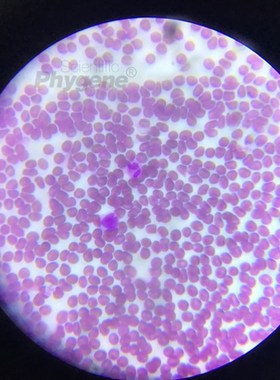 迪夫快速染色液细胞染色血液涂片染色 Diff Qui tin HGENE