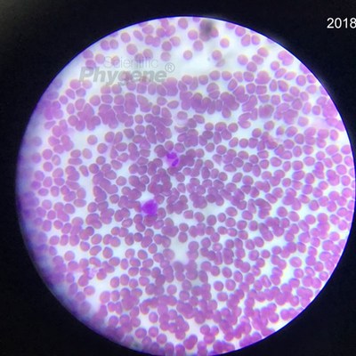 迪夫快速染色液细胞染色血液涂片染色 Diff Qui tin HGENE