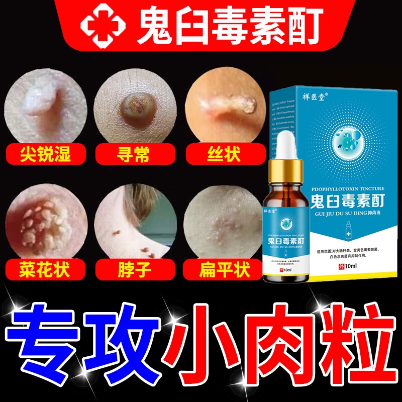 犹猴尤瘊肉粒一抹无忧去除神器鬼臼毒素酊尤脱正品欣药克国字液准