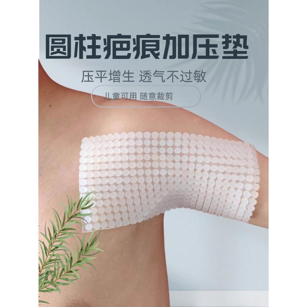 圆柱疤痕加压垫术后疙瘩防增生疤痕贴硅凝胶弹力套儿童烧烫伤增压