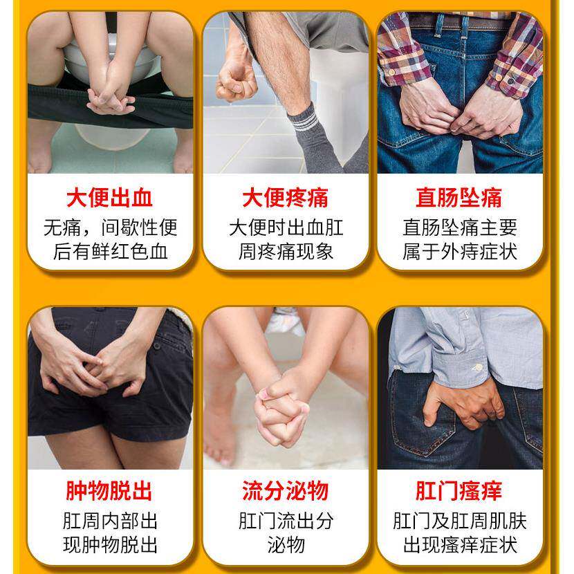 痔疮膏肉球块强效肛门瘙痒小肉球混合便秘坐便屁股痒脱肛痔疮湿巾