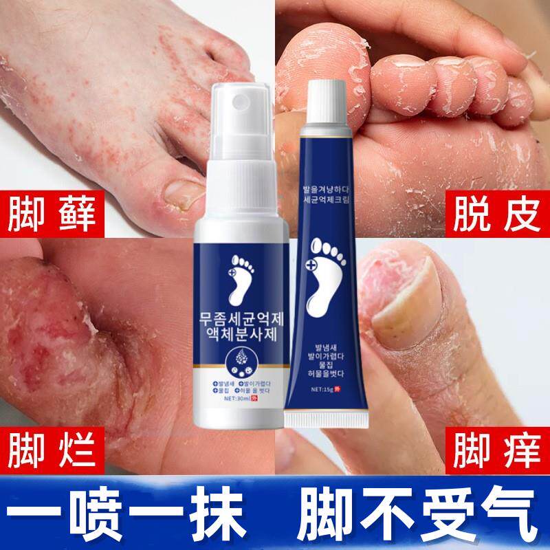 姚本仁斩草除根脚气王喷剂止痒脱皮杀菌除脚丫脚臭水泡型喷雾