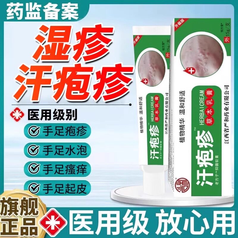 汗泡疱疹膏手上起小水泡孢疹专用软膏汗状止痒真菌感染汗泡疹膏