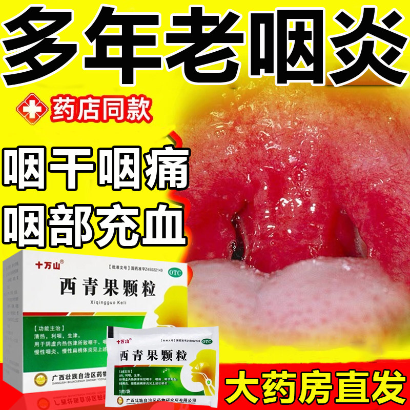 慢性咽炎颗粒冲剂嗓子疼喉咙有痰咽喉发炎红肿充血消炎下火西青果