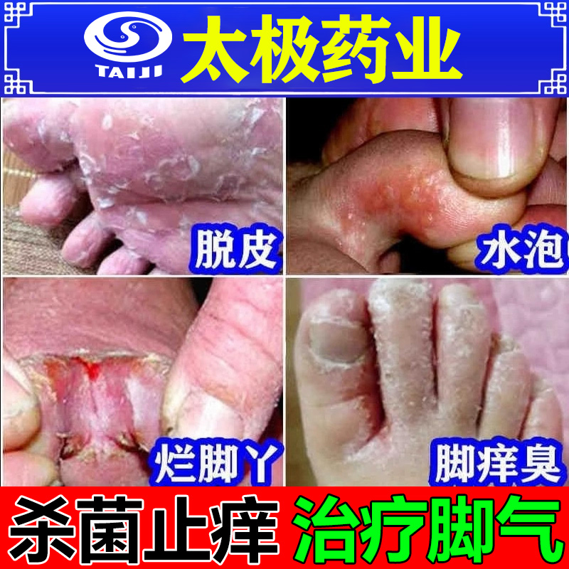【太极】盐酸特比萘芬凝胶1%*20g*1支/盒