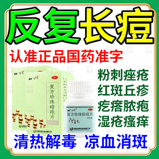 祛痘药内服口服中成药清热解毒凉血消斑治疗粉刺痤疮痘痘红斑丘疹