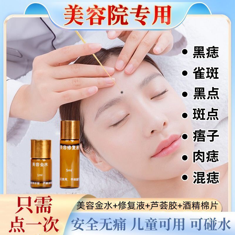 点斑去痣点痣膏脸部专用除去黑痣痣神器无痕正品美容点痣金水5831