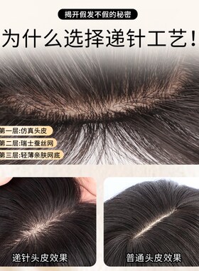 假发女片头顶遮白发蓬松高颅顶自然无痕前额全真发递针刘海补发片
