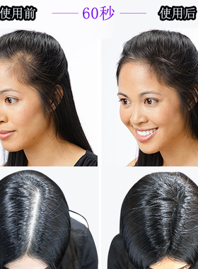 密丰密发增发纤维假发男补充包袋装粉快速美发变多变密发头发稀疏