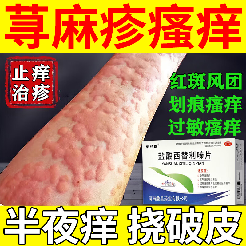 【ccpc】盐酸西替利嗪片10mg*12片/盒