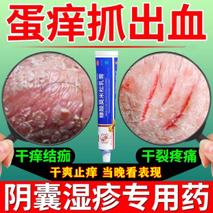 治疗男性阴囊湿疹瘙痒潮湿私处睾丸止痒药膏糠酸莫米松软乳膏正品