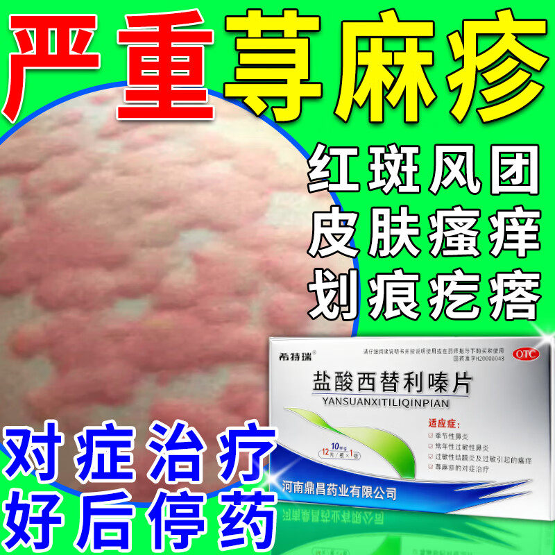 盐酸西替利嗪片荨麻疹过敏止痒断专用药根 寻荨麻疹的特效期药
