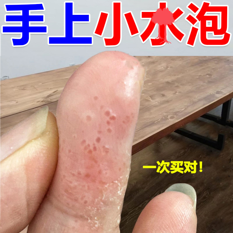 从根源改善水疱消疱修护一步到位