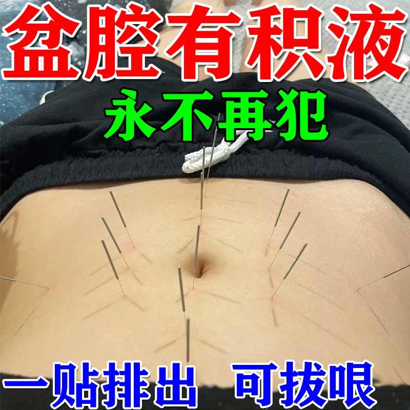 轻松排】盆腔输积水积液卵输管疏不通热敷包通而不畅黏连堵塞贴膏