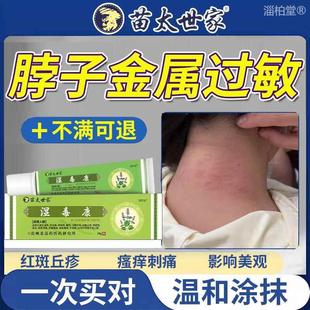 脖子金属过敏搭药膏防过敏涂层贴液皮肤接触性皮炎皮疹抑菌止痒UA