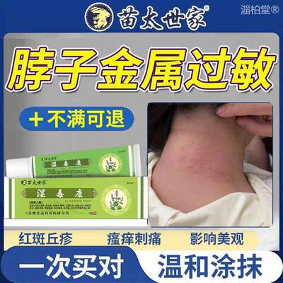 脖子金属过敏搭药膏防过敏涂层贴液皮肤接触性皮炎皮疹抑菌止痒UA