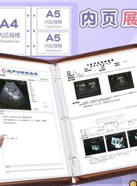 孕检收纳册手提孕期档案册报告单p孕妈妈孕妇b超手册产检本报告单