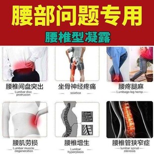 腰椎疼痛喷剂治腰间盘后背部酸痛压迫神经椎管狭窄突出疼痛专用药