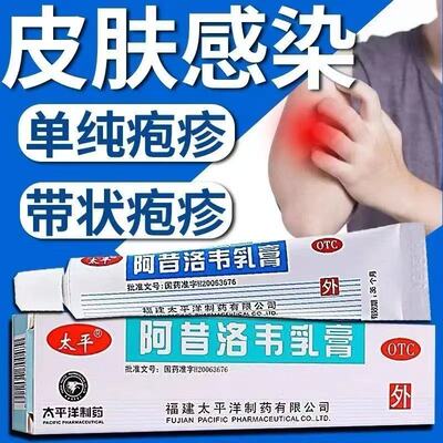 抗病毒外涂单纯带状疱疹感染阿昔洛韦乳膏软膏正品otc