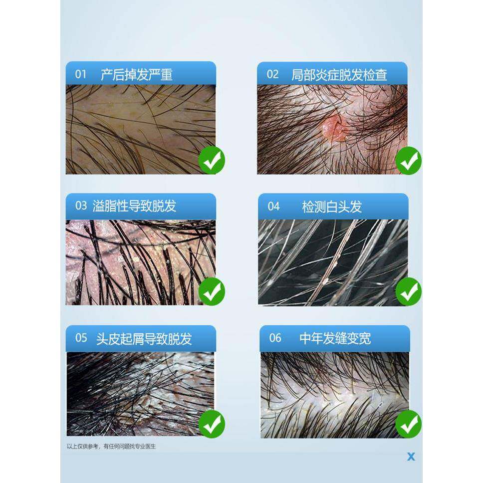 米诺头皮上药器可视导液毛囊高摄HTC像头电动红光滚梳按摩神珠清