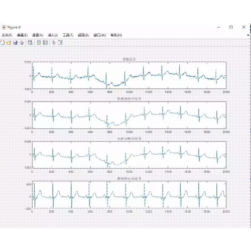 心电信号ECG去噪Matlab程序使用低通滤波和小波分解结合