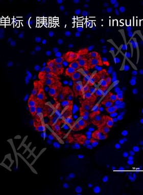 免疫组化(IHC)免疫荧光(IF) Tunel 凋亡 细胞实验图片量化分析