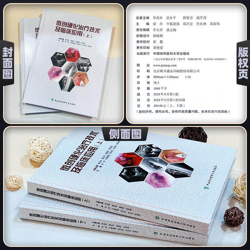 微创硬化治疗技术及临床应