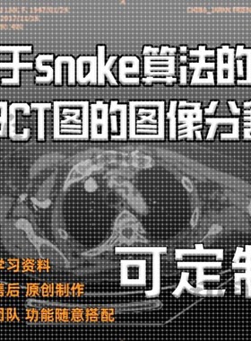 基于snake算法的肺部CT图的图像分割/数据分割技术