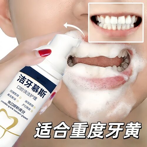 【山姆断货王】牙石清理神器溶解茶渍烟渍污垢牙垢口腔修护慕斯