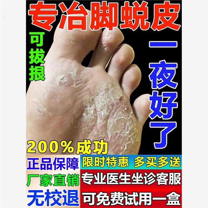 脚掌脱皮脚底掉皮脱皮专用膏真菌感染起皮粗糙干燥干裂去死皮药膏