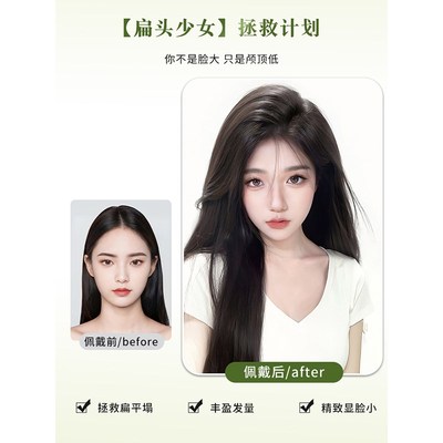 假发女片头顶蓬松增发量全真人发垫发片垫发根隐形无痕高颅顶神器
