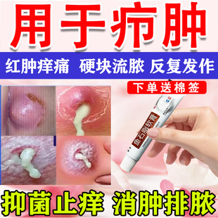 鱼石脂软膏私处疖肿外阴火疖子拔毒拔脓膏硬块屁股长疙瘩特新效药