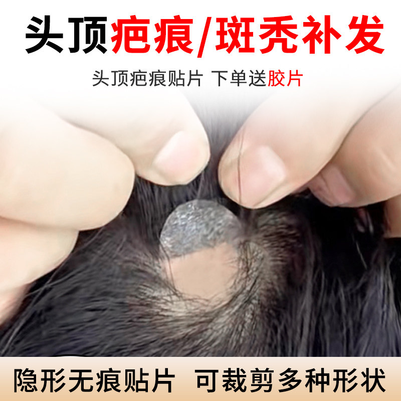 疤痕补发贴片头顶斑秃烧伤疤痕小面积假发贴片男女生物头皮全真发,美发护发/假发,日常整顶假发,淘宝优惠券,粉丝福利购,淘宝优惠卷