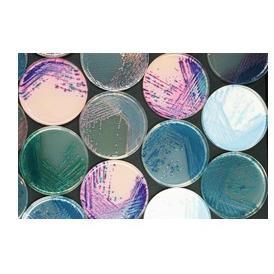 1000ml弧菌显色培养基(副溶血性)等显色培养基干粉系列