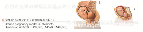 SMO0174九个月子宫妊娠教学模型
