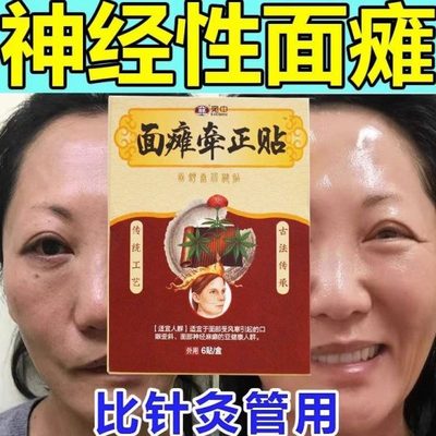 眼贴正面部后斜康复遗症恢复僵专用专用硬联牵面瘫贴动药嘴歪