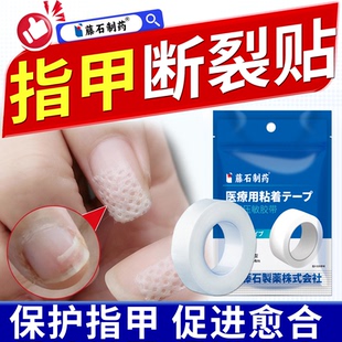 藤石制药手指甲盖劈裂开裂修复贴断裂修补保护套医用级压敏胶带YJ