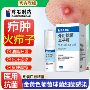 藤石制药抗菌离子膜搭火疖子拔毒拔脓膏脓包硬块疖肿细菌毛囊炎LQ