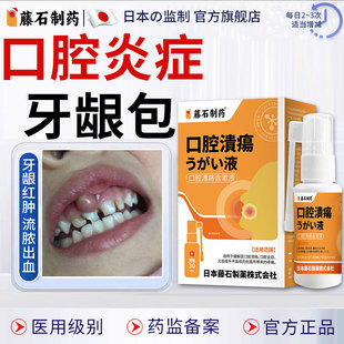 口腔炎症牙龈脓包可搭发炎出血根尖囊肿效特药监备案用含嗽液NP