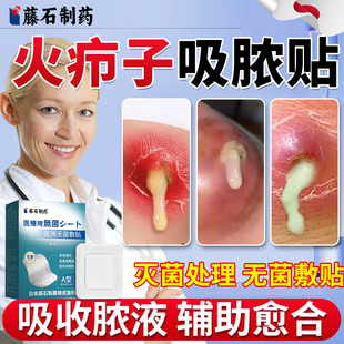藤石制药火疖子疖肿伤口敷料贴毒脓膏脓包硬块吸脓贴神无菌器NP