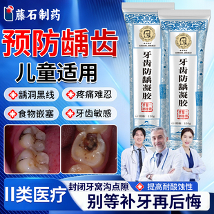 藤石制药儿童防蛀牙龋齿修复去黑线牙洞清理牙虫可搭含氟牙膏YZ