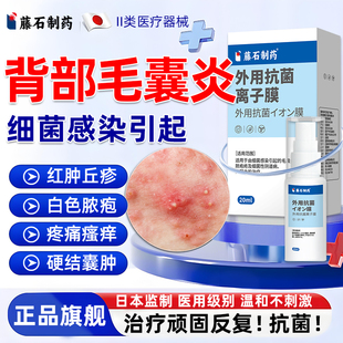 藤石制药背后长痘痘后背毛囊炎细菌性喷雾剂硬疙瘩前胸搭沐浴露E8