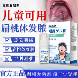 儿童急性扁桃体反复化脓发炎肥大肿大咽喉肿痛喷雾剂可搭膏药贴ZZ